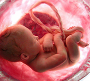 Chapter 5. History of Abortion in Russia